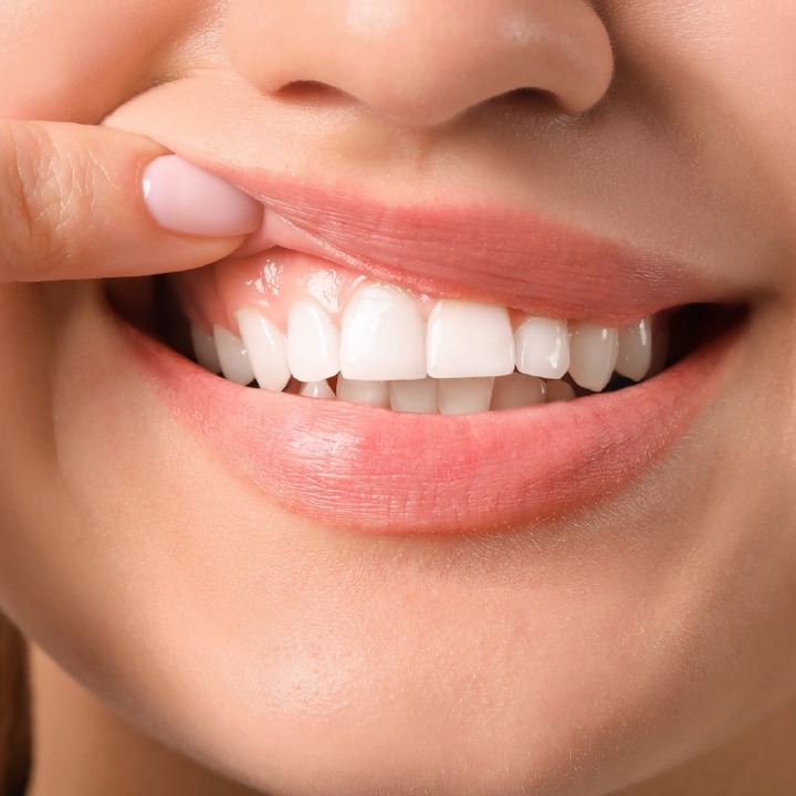 Stop Wasting Money on Dentists: Simple Ways to Protect Your Teeth at Home