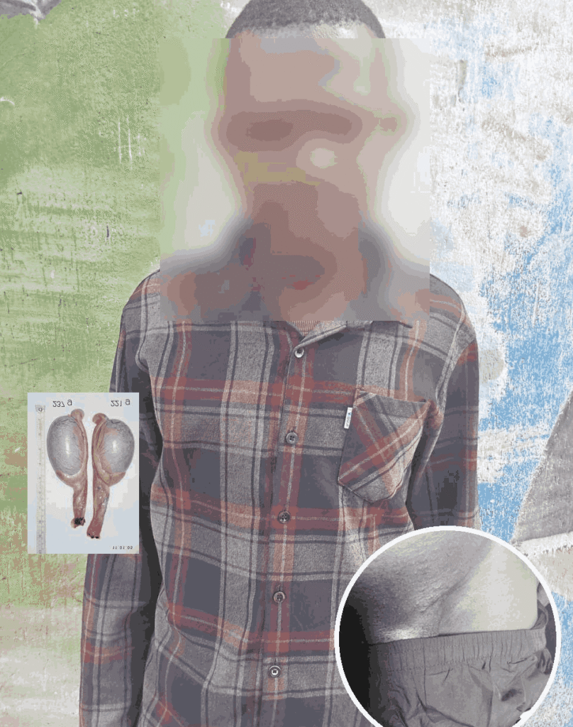 Ugandan Man Accuses Hospital of Removing His Testicle Without Consent